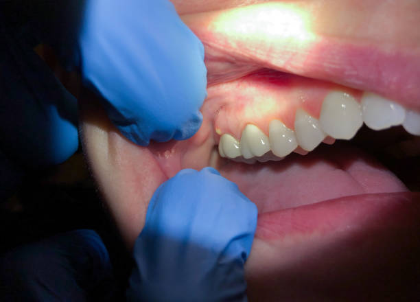 Best Emergency TMJ Treatment in Fairmount, CO