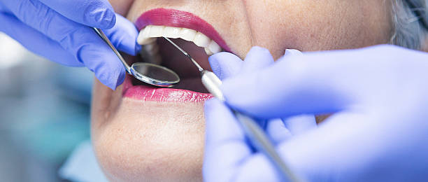 Best Emergency Tooth Extraction in Fairmount, CO