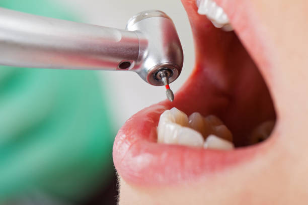 Best Same-Day Emergency Dental Services in Fairmount, CO
